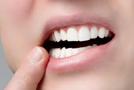 Что такое протезирование зубов и для чего оно нужно